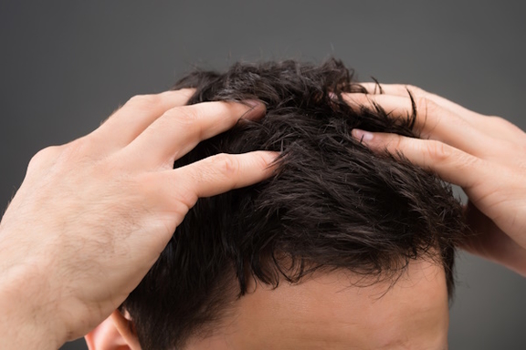 Pflege nach Haartransplantation - AEZ Hair, Haarzentrum in München